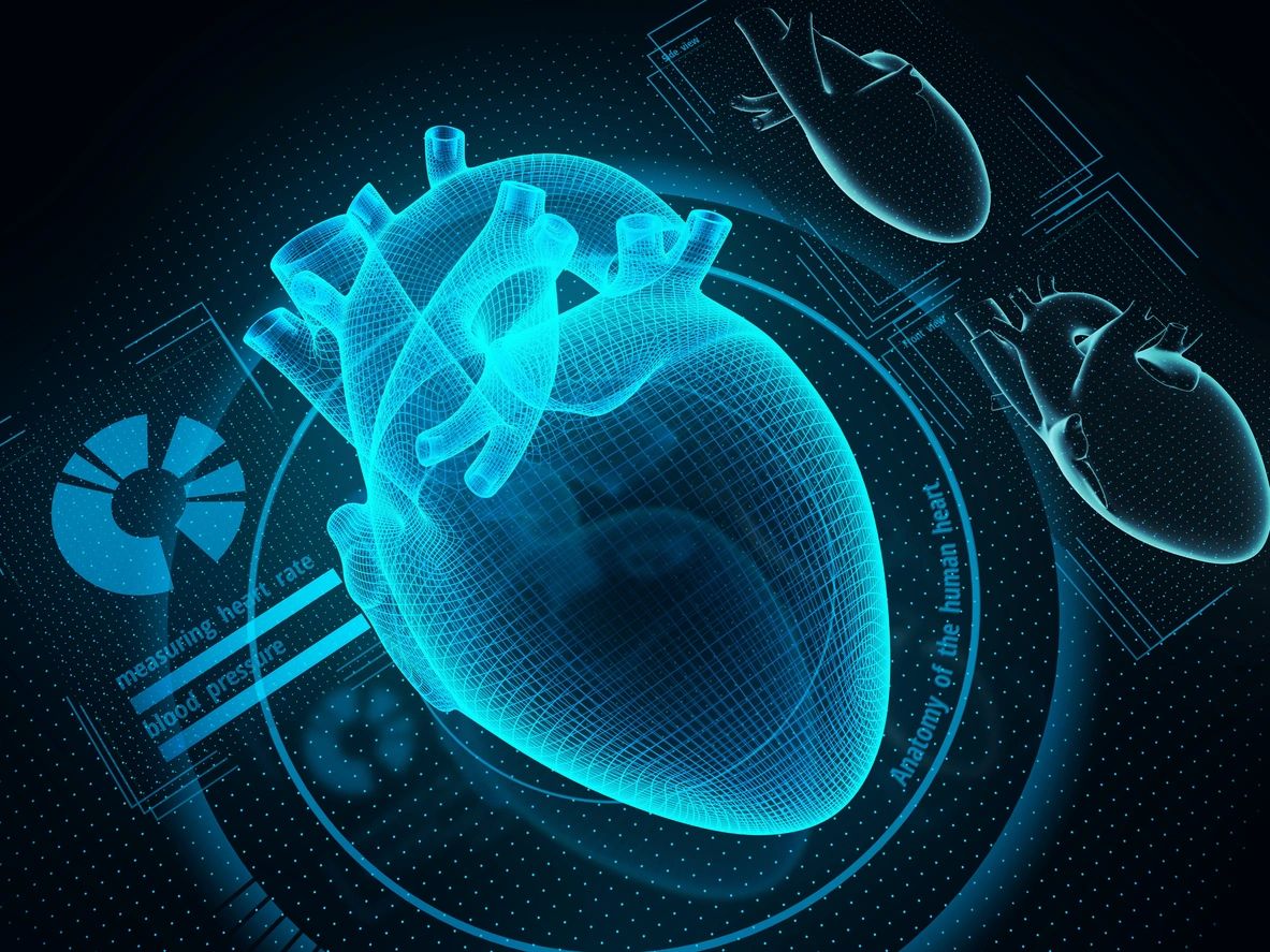 RT Cardiac Systems